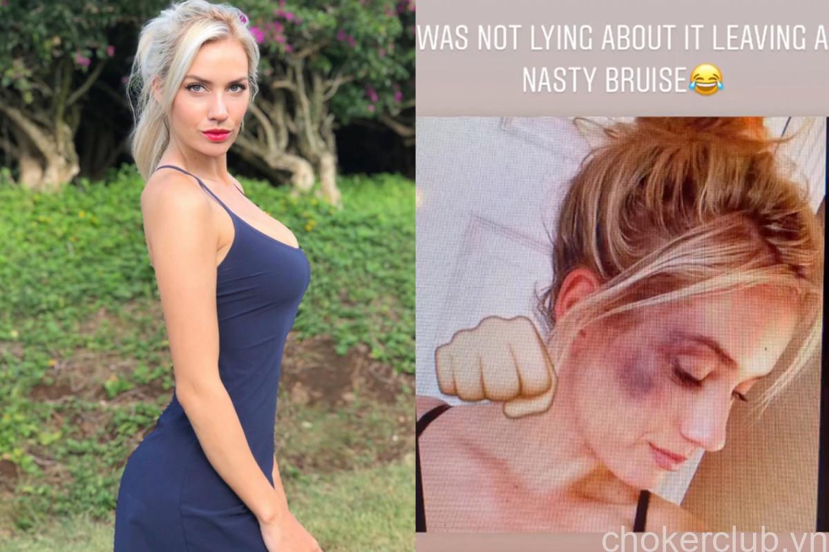 Paige Spiranac: Speaking Out Against Cyberbullying
